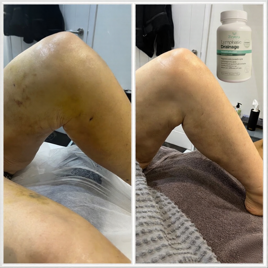 Lymphatic Drainage Capsules